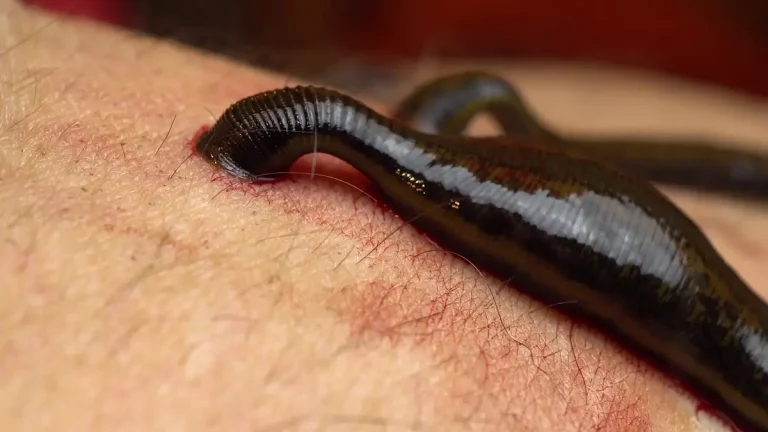 Leeches attached the skin of a human